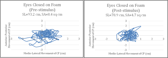 Two graphs showing balance stability before and after expusure to motion sickness with the post motion sickness results showing a better balance.