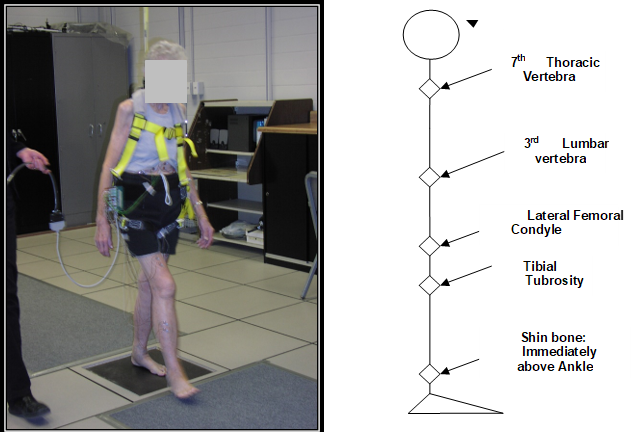 A person wired to measurement equipment. Also, a chart showing the location of measurement points. 7th Thoracic Vertebra, 3rd Lumbar vertebra, Lateral Femoral Condyle, Tibial Tubrosity, and Shin Bone immediately above ankle.