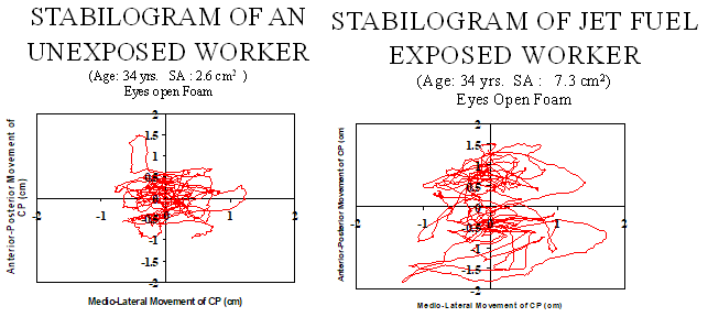 Two graphs comparing the balance stability of an unexposed worker with a jet fuel exposed worker. The jet fuel exposed results show increased movement compared to the unexposed worker.