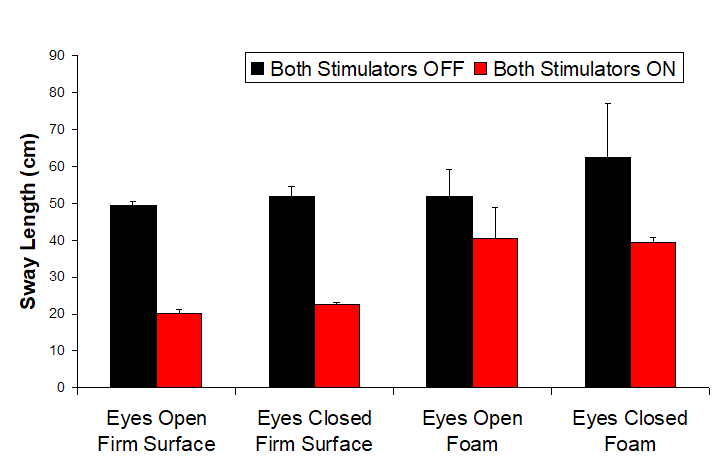 A bar chart of 4 seperate measurements. Eyes closed and opened on a firm surface, and eyes closed and opened on a foam surface. Each result shows the patients with brain stimulation have a lesser sway length on every surface