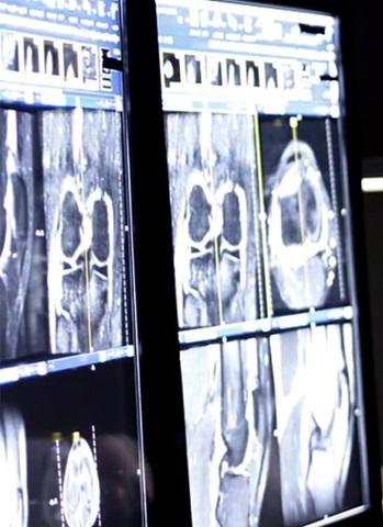 Radiology Scans