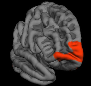 MRI Image of Brain