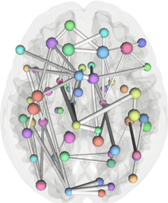 Network view of brain