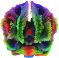 Whole brain diffusion tractography image