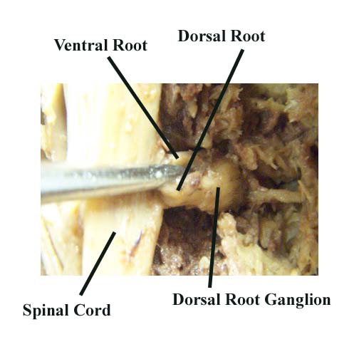 spinal cord nerves cadaver