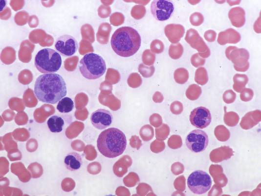 eosinophilic myelocytes sl 177